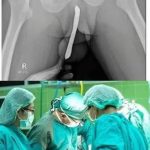 Doctors are speechless: Just boil these 2 ingredients and you will quickly lose your body fat !!