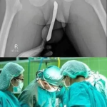 Doctors are speechless: Just boil these 2 ingredients and you will quickly lose your body fat !!
